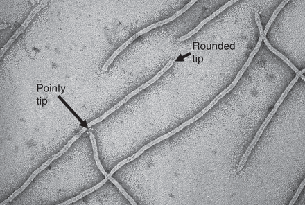 High-resolution negative-stained electron micrograph of filamentous phage virions. Putative pointy and rounded tips are indicated. Courtesy of Lee Makowski, Northeastern University, with permission.